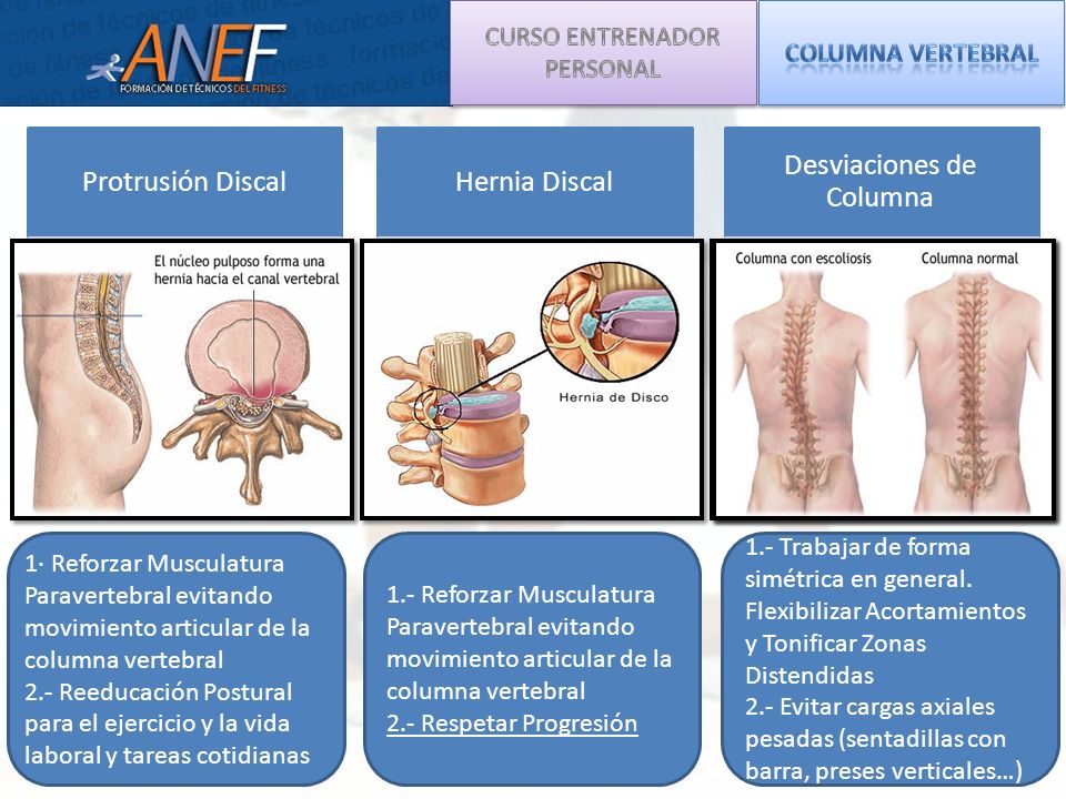 Si es posible correr a la escoliosis y la osteocondrosis